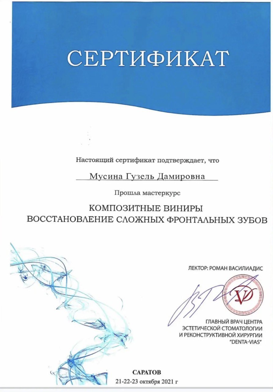 Композитные виниры в Казани